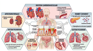 Infographic in Romanian showing a central human figure with surrounding panels about organ systems and diseases (cardiovascular, renal, pulmonary, diabetes, arthritis).